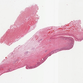 Gastrointestinale Tumoren Internationale Akademie für Pathologie