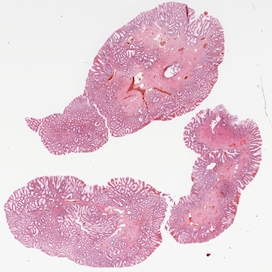 Häufige Probleme in der Gastrointestinalen Pathologie ...