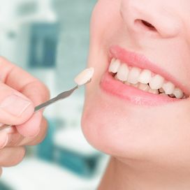 Merrylands Dentist: Krown Dental - Your Smile's Best Companion