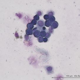 G-186. Liquid-Based Cytology
