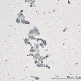 G-186. Liquid-Based Cytology